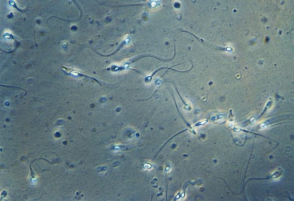 Ученые предупредили об опасном обеднении спермы у жителей развитых стран | - «Интернет и связь»